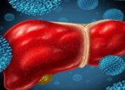 Sudah 14 Kasus Hepatitis Akut Misterius di RI, Ini Penjelasan Kemenkes