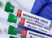 Pasien Cacar Monyet Butuh Penanganan Simptomatik dan Antivirus