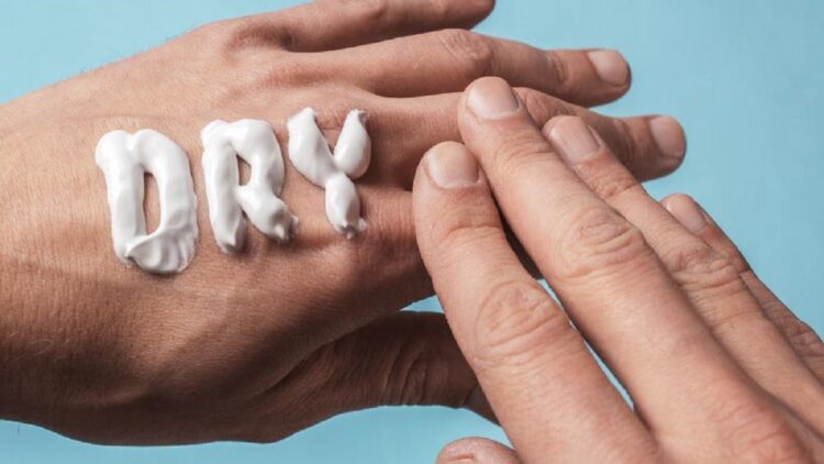 ilustrasi kulit kering. (Dok. istimewa)