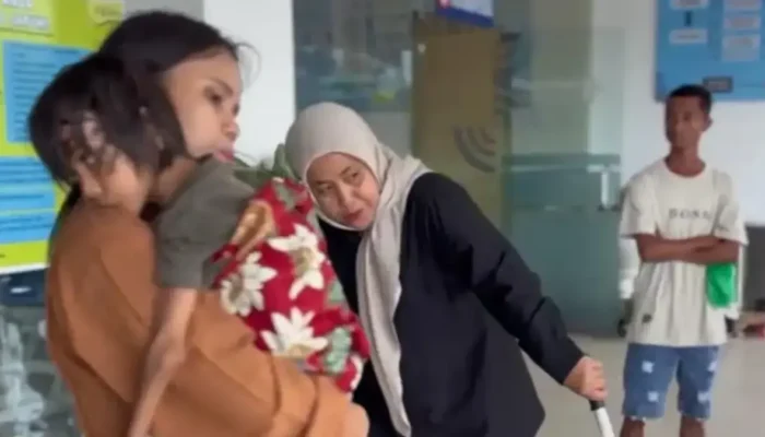 RSUP Dr M Djamil Bergerak Cepat Tangani Pasien Anak Suspect Lipoma