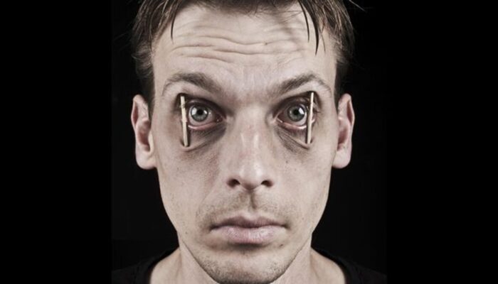 Stres Kronis dan Kurang Tidur Turunkan Kualitas Sperma, Ini Penjelasan Dokter