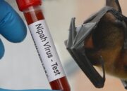 Belum Ada Vaksin, Deteksi Dini jadi Kunci Cegah Kematian Akibat Virus Nipah