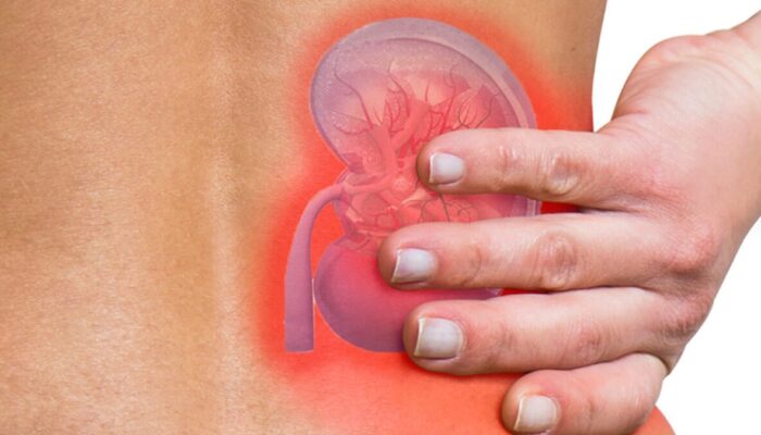 Dokter Ungkap Manfaat Puasa untuk Kesehatan Ginjal