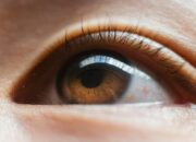 LASIK Mata untuk Atasi Rabun Jauh, Rabun Dekat, dan Silinder