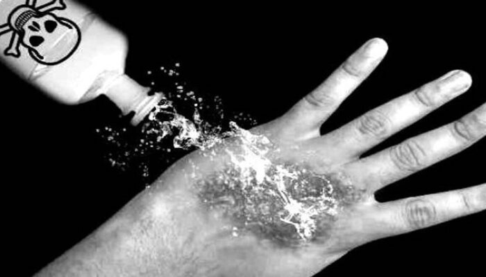 Pemerintah Kecam Penyiraman Air Keras terhadap Andrie Yunus, Polisi Diminta Usut Tuntas