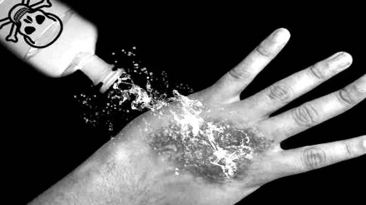 ilustrasi penyiraman air keras. (dok. istimewa)