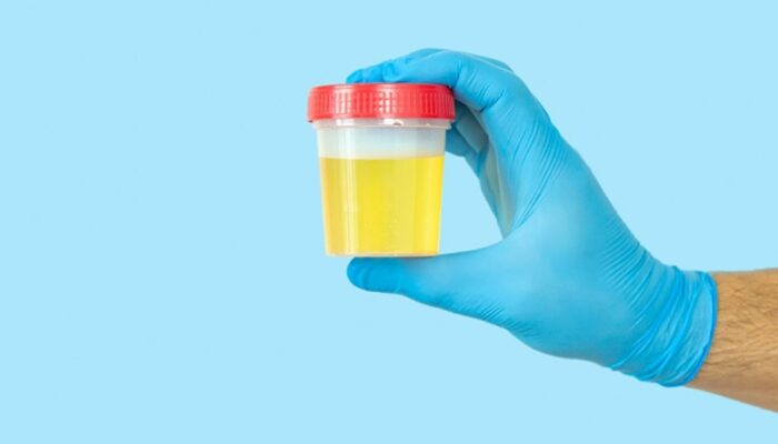 Cegah Narkoba, Lapas Dharmasraya Periksa Urine Pegawai dan Warga Binaan