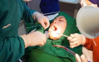 Pipi Chubby Padahal Berat Badan Ideal? Kenali Buccal Fat Removal